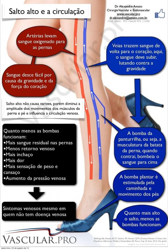 É possível usar salto alto sem prejudicar a coluna?