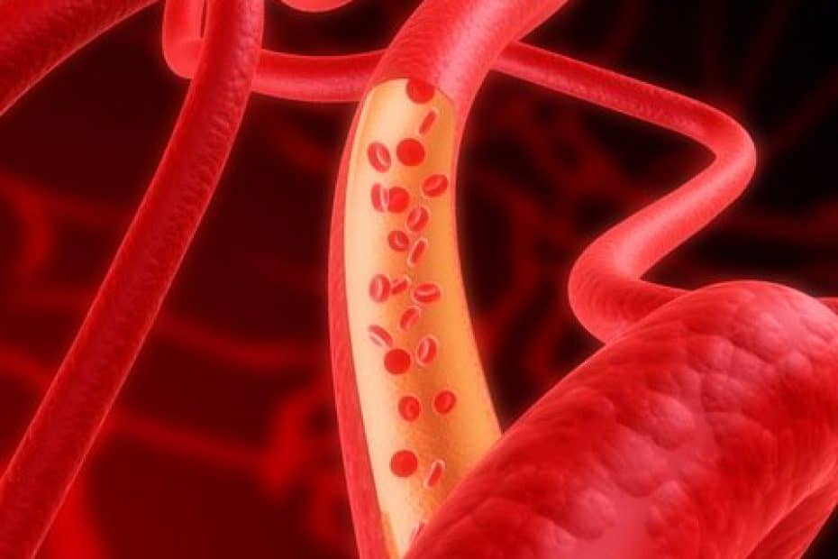 cirurgia vascular - Vaso sanguíneo