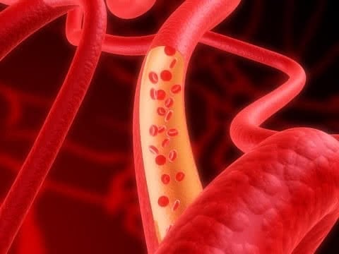 tratamento de varizes, vasinhos, veias varicosas, mas também artérias, aneurismas, estenoses, fístulas e outros