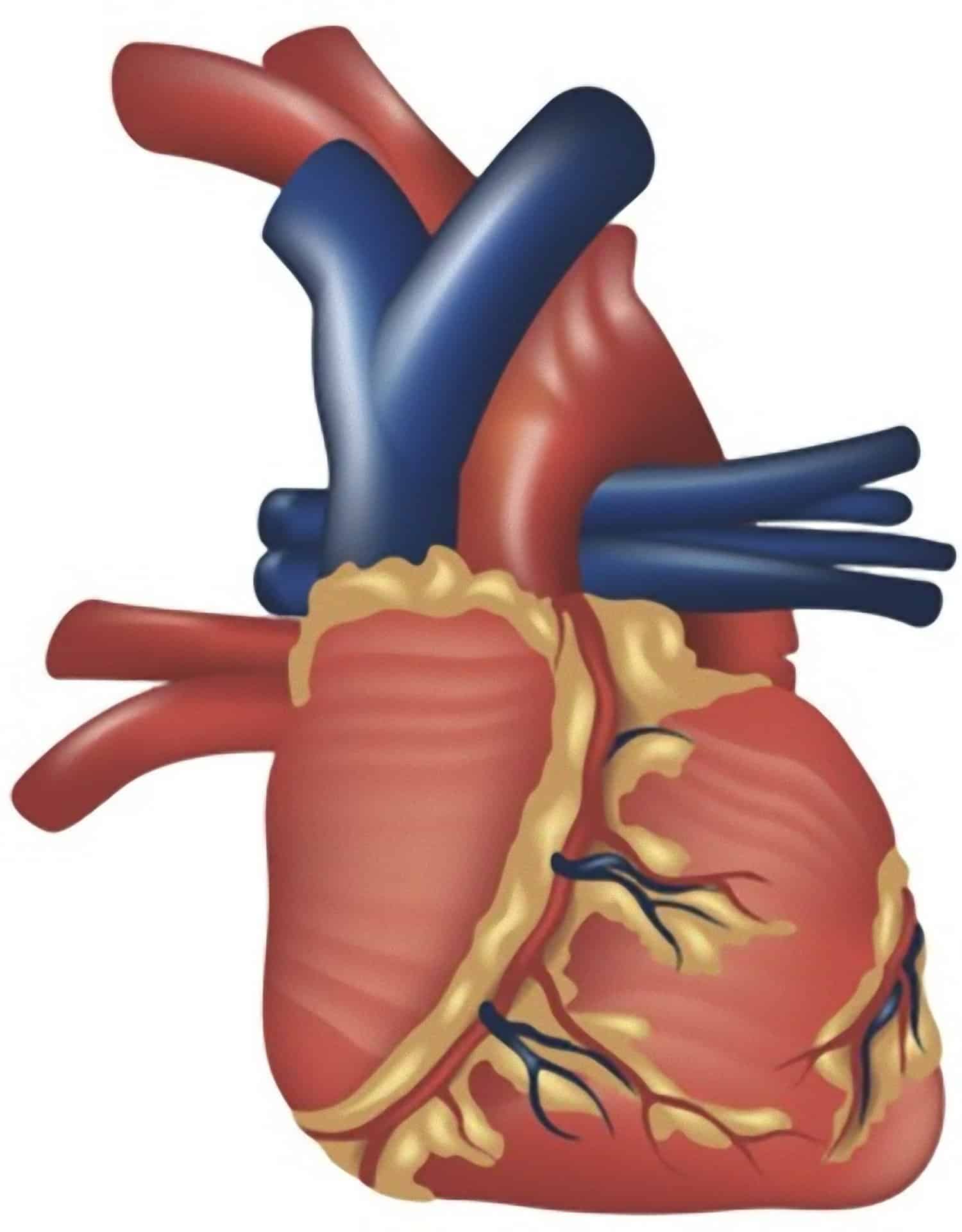 Infarto do Miocárdio