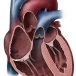 heart-coronal-cut