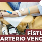 Fístula Arterio Venosa