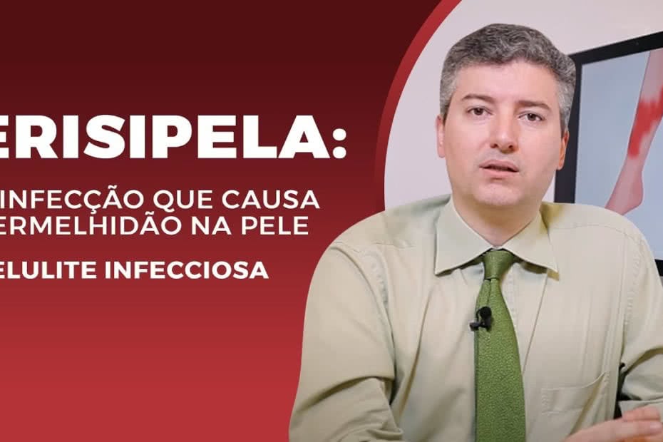 Erisipela