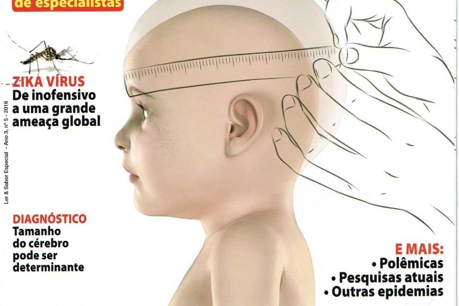 microcefalia_-_perguntas_e_respostas_0