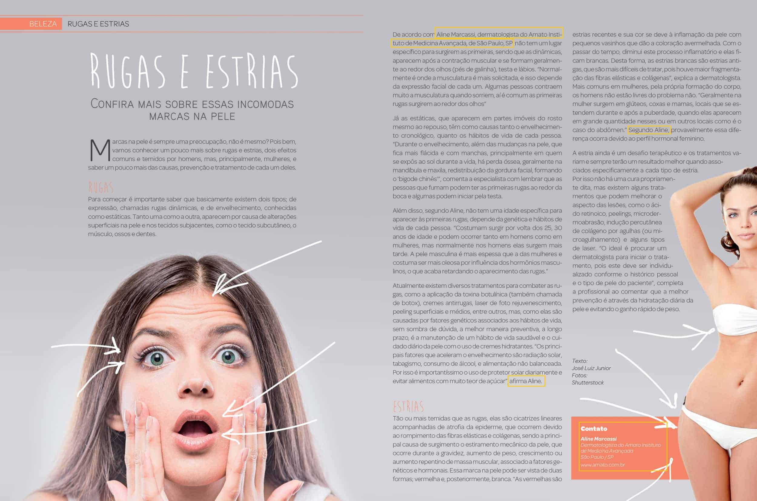 Rugas e Estrias