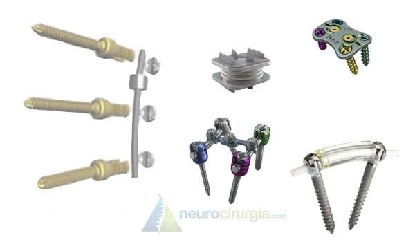 Cirurgia da Coluna