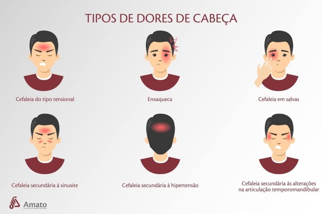 tipos de dor de cabeça