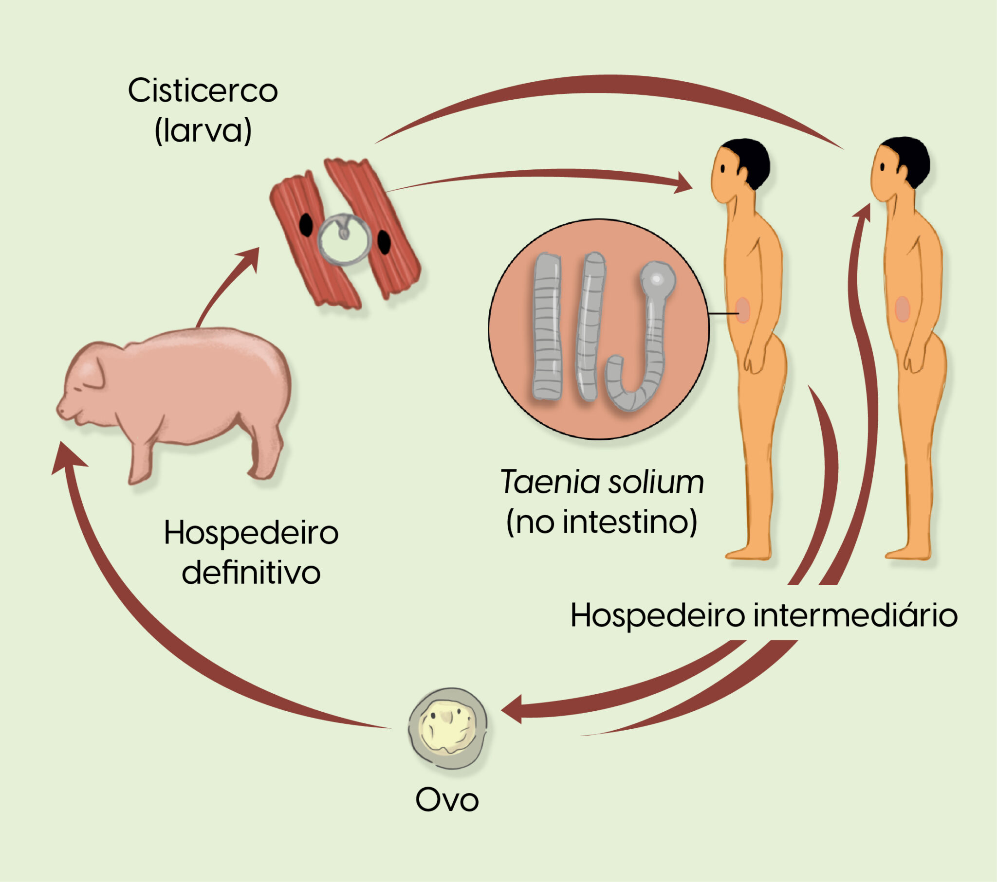 Neurocisticercose: sintomas, diagnóstico e tratamento da cisticercose ...