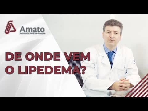 Lipedema: Conheça a condição médica que causa acúmulo de gordura