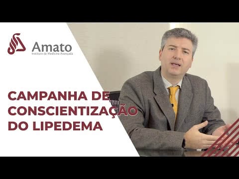 Lipedema: Conheça a condição médica que causa acúmulo de gordura