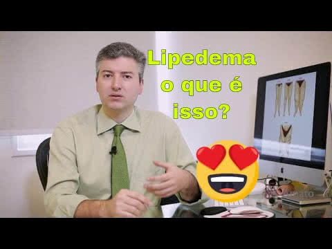 Lipedema: Conheça a condição médica que causa acúmulo de gordura