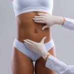 Abdominoplastia pós gestação
