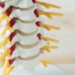 Infiltração de coluna