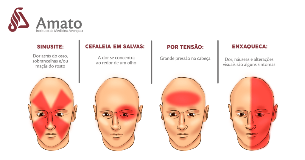 Tipos de Dores de Cabeça e suas causas