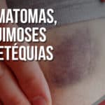 Hematomas, equimoses e petéquias