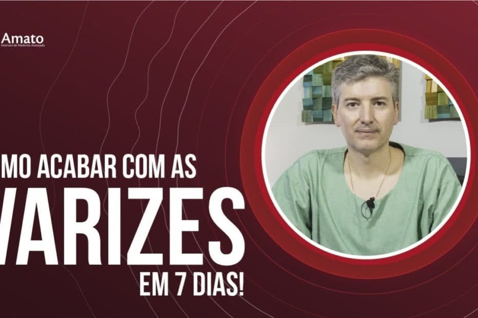 Acabar com as varizes