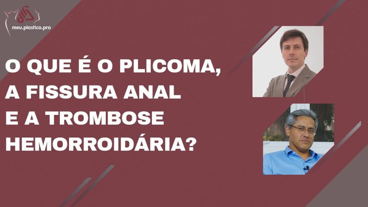 Prolapso anal peixes Como fazer sexo oral na mulher sem pegar herpes