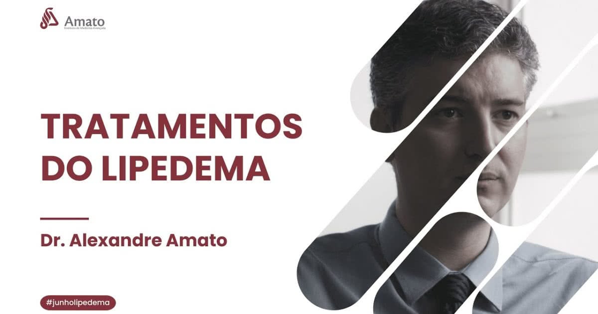 Dr Alexandre Amato Os Tratamentos Do Lipedema E Suas Diferenças Amato
