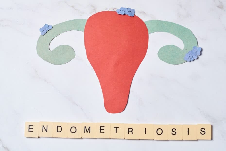 Endometrite: o que é?