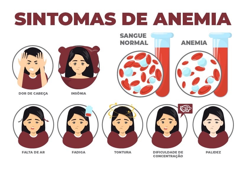 Sintomas de anemia