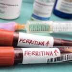 Ferritina elevada e medicamento